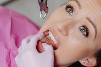 Hilfe bei Dentophobie  - Zahnarztangst – Dentalphobie - Praxis für Veränderungscoaching und Therapie bei Ängsten und Phobien - www.angst-phobie.ch